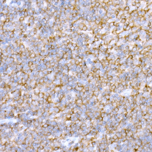 NMI Rabbit monoclonal antibody