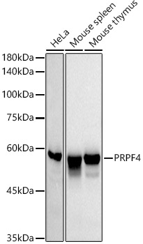 PRPF4 Rabbit monoclonal antibody