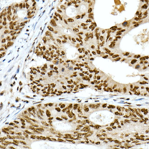 PRPF4 Rabbit monoclonal antibody