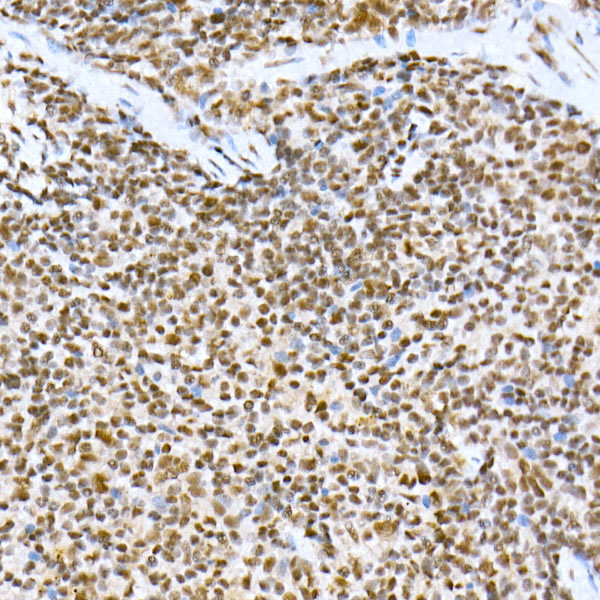 PRPF4 Rabbit monoclonal antibody