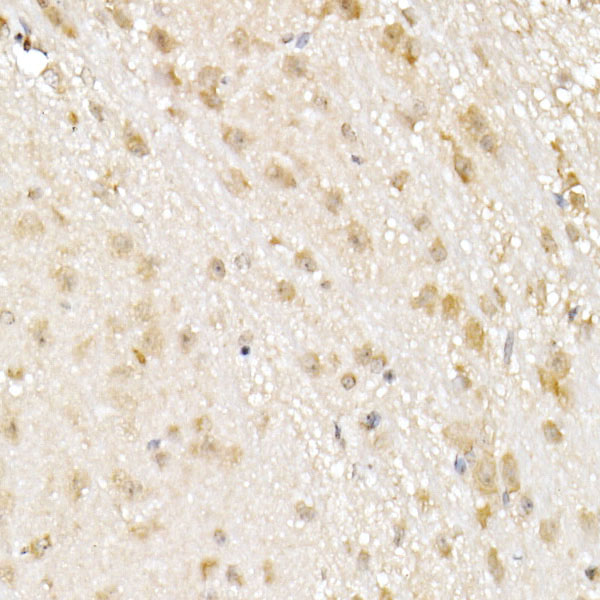 NOLC1 Rabbit monoclonal antibody