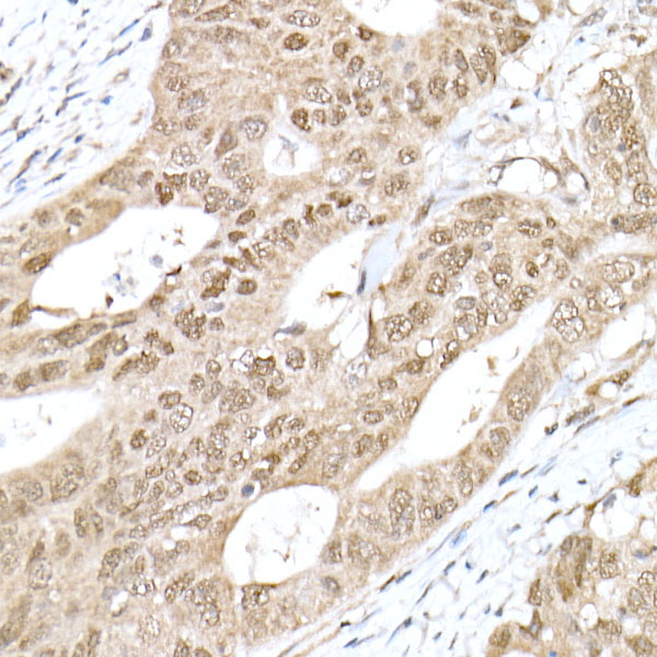 RNF7 Rabbit monoclonal antibody