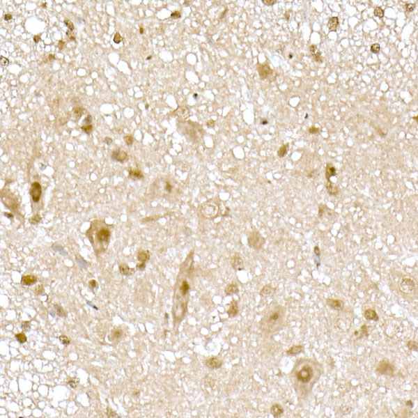 RNF7 Rabbit monoclonal antibody