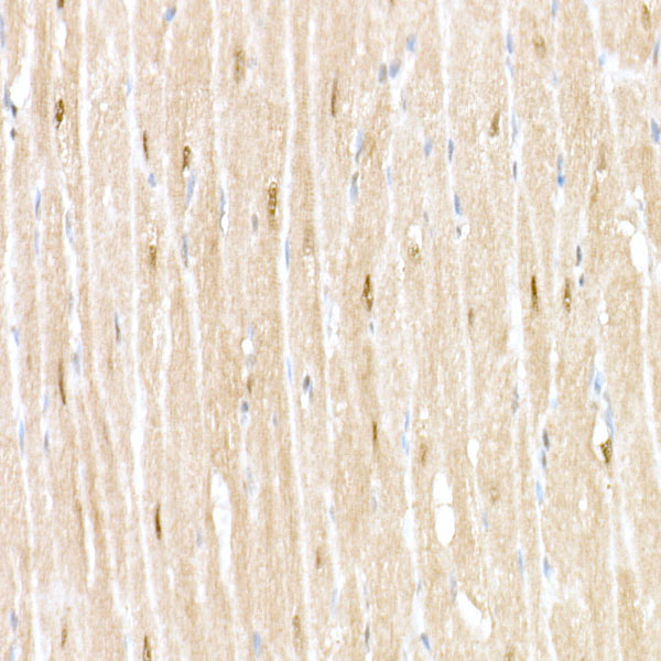 RNF7 Rabbit monoclonal antibody