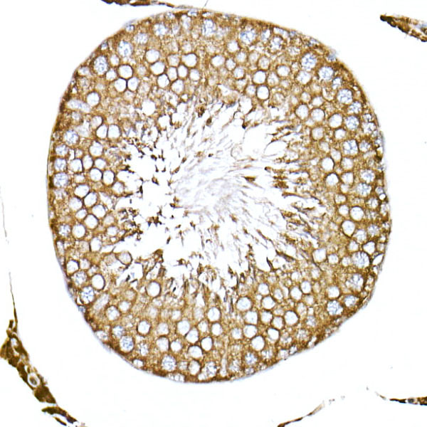 ACTR1B Rabbit monoclonal antibody
