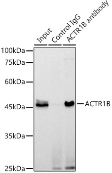 ACTR1B Rabbit monoclonal antibody