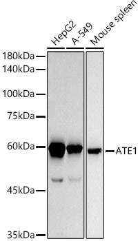 ATE1 Rabbit monoclonal antibody