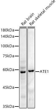 ATE1 Rabbit monoclonal antibody