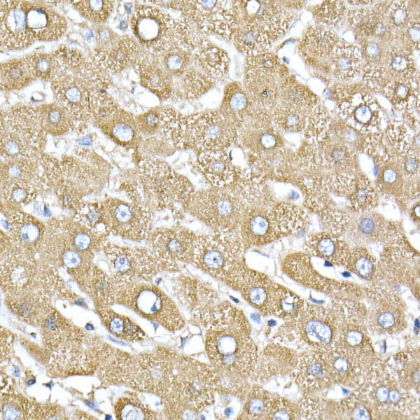 ATE1 Rabbit monoclonal antibody