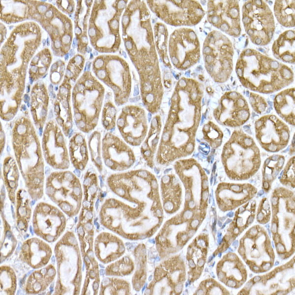 ATE1 Rabbit monoclonal antibody