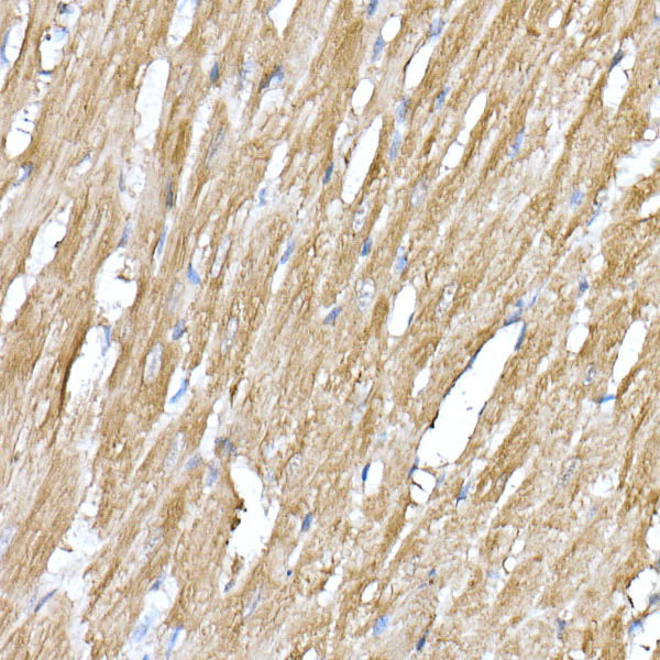 ATE1 Rabbit monoclonal antibody