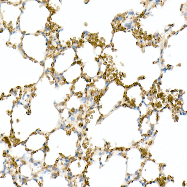 CD147 Rabbit monoclonal antibody