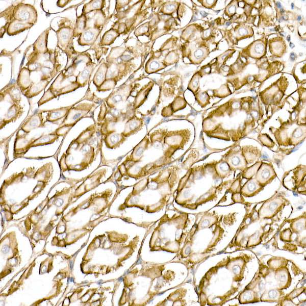 CD147 Rabbit monoclonal antibody