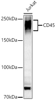 CD45 Rabbit polyclonal antibody