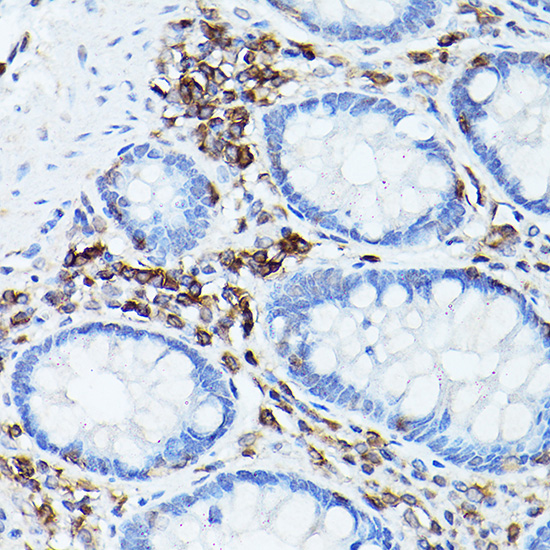 CD45 Rabbit polyclonal antibody