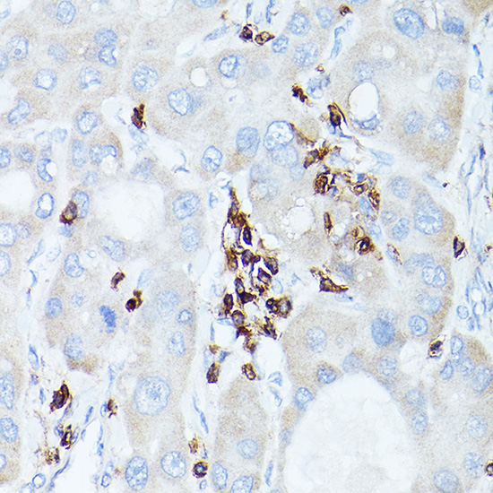CD45 Rabbit polyclonal antibody