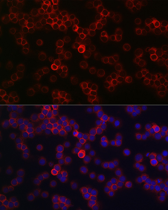 CD45 Rabbit polyclonal antibody
