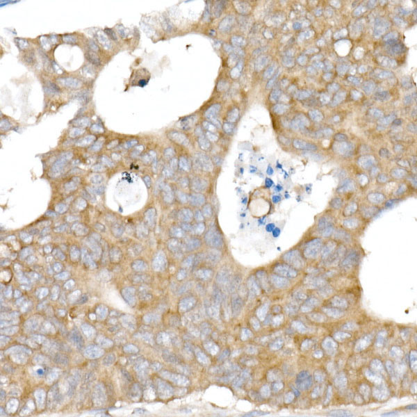 SNX5 Rabbit monoclonal antibody