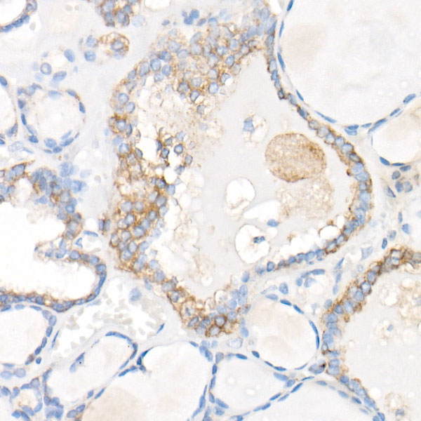 SNX5 Rabbit monoclonal antibody