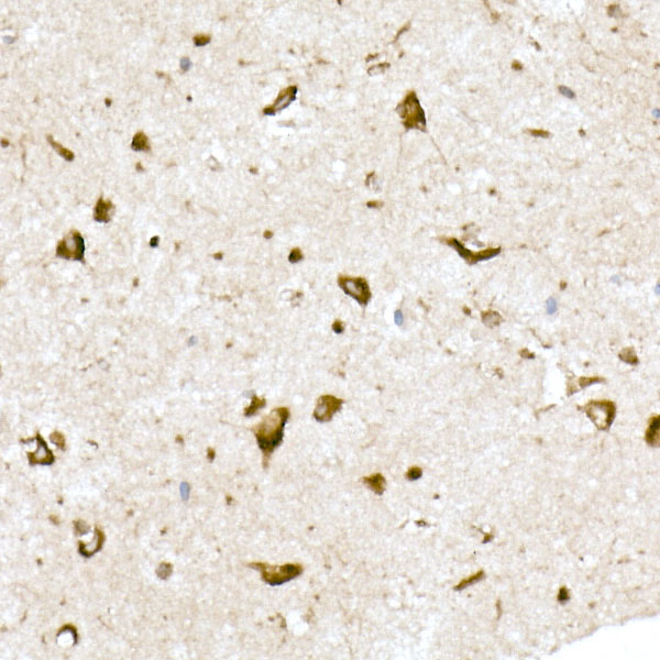 EMC4 Rabbit monoclonal antibody