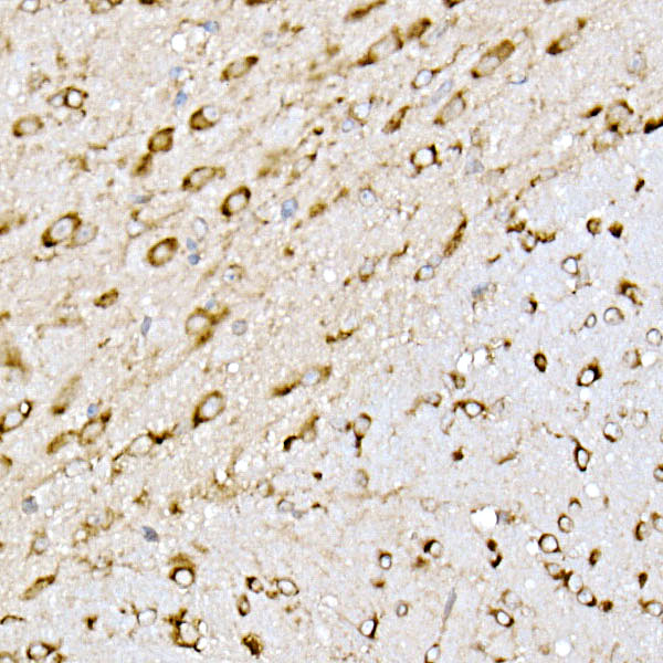 EMC4 Rabbit monoclonal antibody