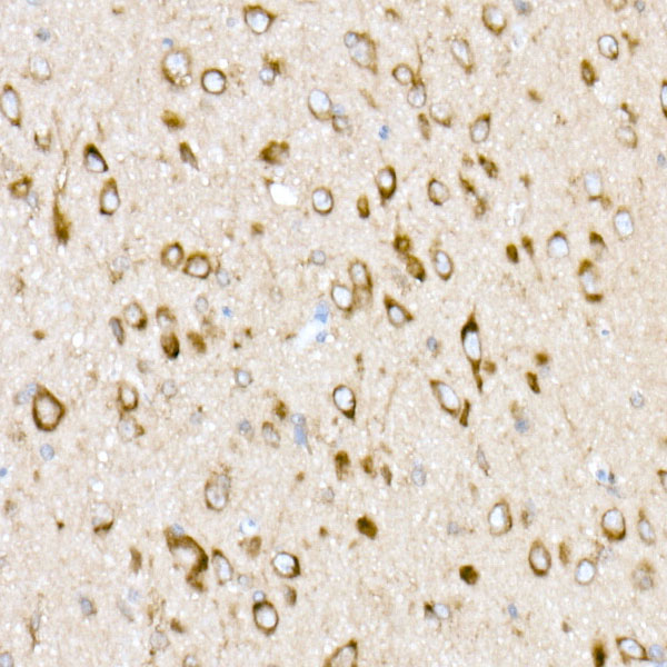 EMC4 Rabbit monoclonal antibody
