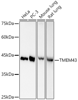 TMEM43 Rabbit monoclonal antibody