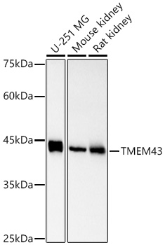 TMEM43 Rabbit monoclonal antibody