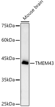TMEM43 Rabbit monoclonal antibody