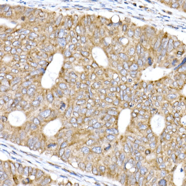 TMEM43 Rabbit monoclonal antibody