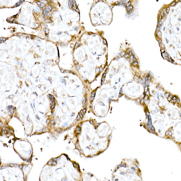 TMEM43 Rabbit monoclonal antibody
