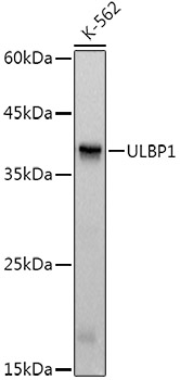 ULBP1 Rabbit monoclonal antibody