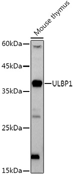 ULBP1 Rabbit monoclonal antibody