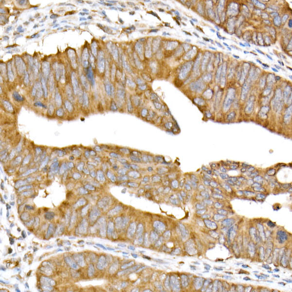 Meckelin Rabbit monoclonal antibody