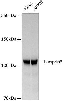 Nesprin3 Rabbit monoclonal antibody
