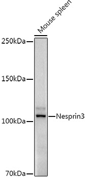 Nesprin3 Rabbit monoclonal antibody