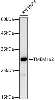 TMEM192 Rabbit monoclonal antibody