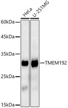 TMEM192 Rabbit monoclonal antibody