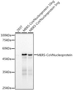 MERS-CoV Nucleoprotein Rabbit mAb