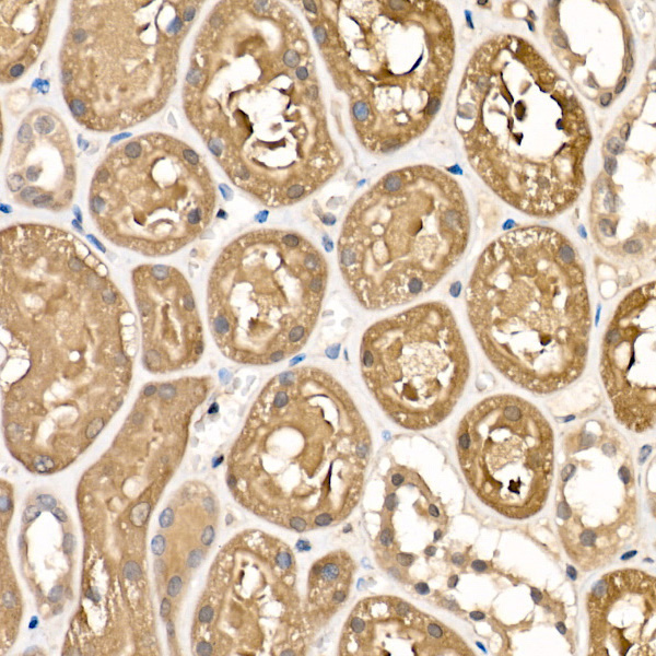 Sorbitol Dehydrogenase Rabbit polyclonal antibody