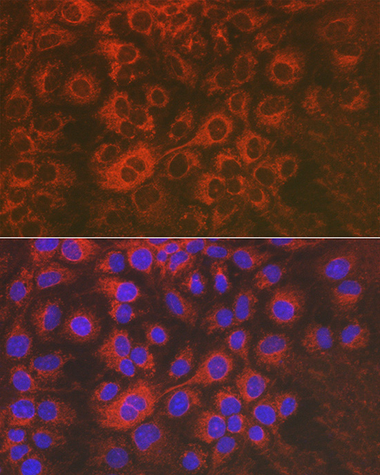 Sorbitol Dehydrogenase Rabbit polyclonal antibody