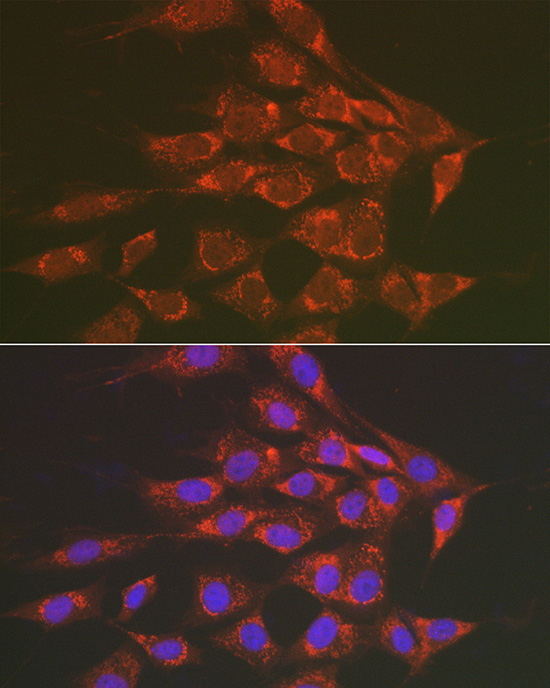 Sorbitol Dehydrogenase Rabbit polyclonal antibody