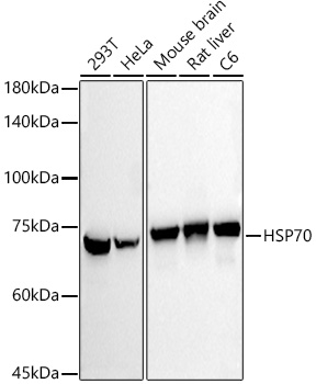 HSP70 Rabbit monoclonal antibody