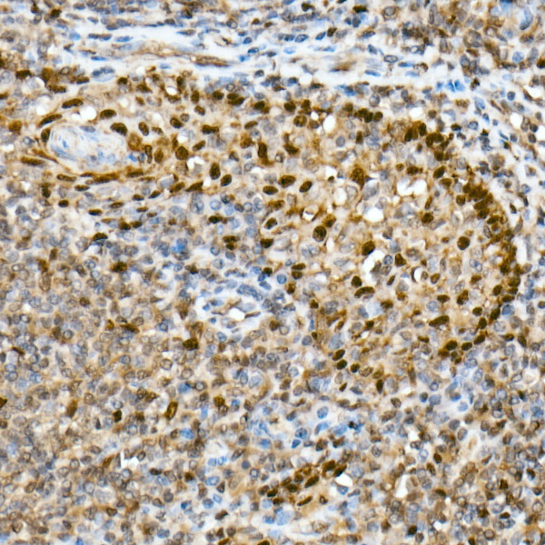 HSP70 Rabbit monoclonal antibody