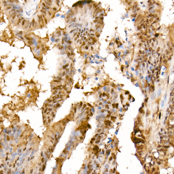HSP70 Rabbit monoclonal antibody