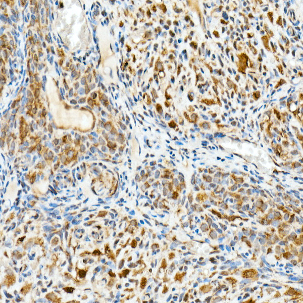 HSP70 Rabbit monoclonal antibody