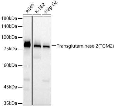 Transglutaminase 2 (TGM2) Rabbit monoclonal antibody
