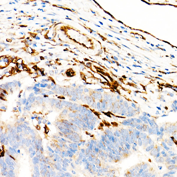 Transglutaminase 2 (TGM2) Rabbit monoclonal antibody