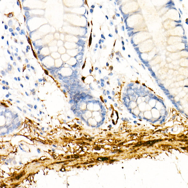 Transglutaminase 2 (TGM2) Rabbit monoclonal antibody