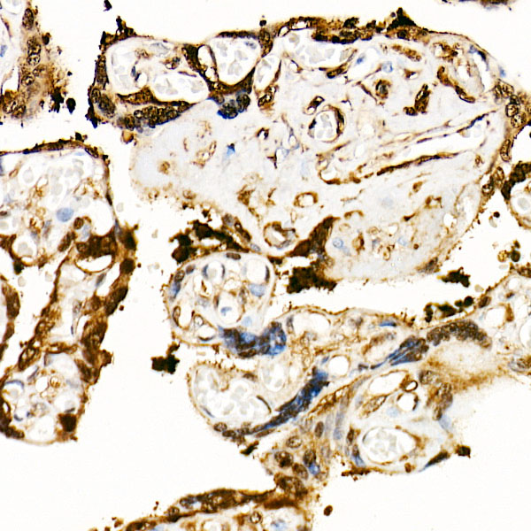 Transglutaminase 2 (TGM2) Rabbit monoclonal antibody